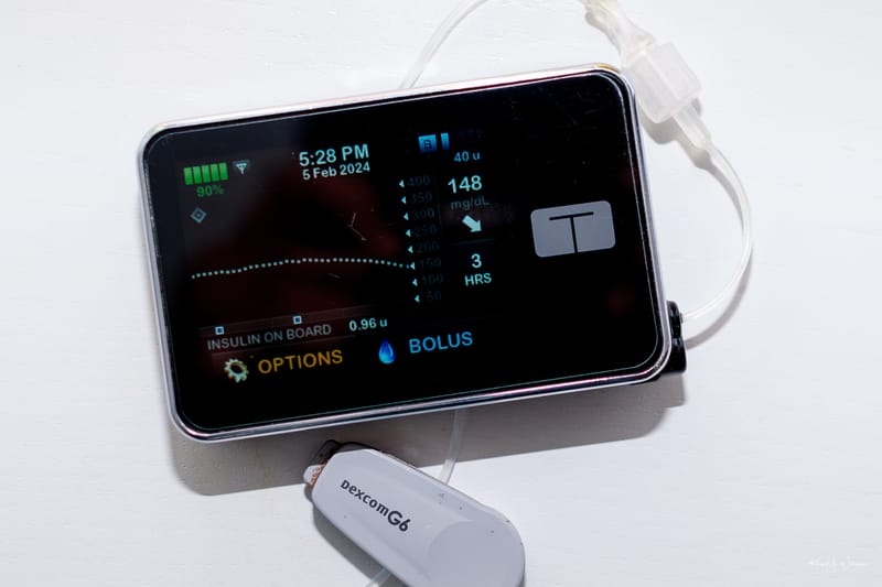 The Benefits of Using an Insulin Pump with a Continuous Glucose Monitor (CGM)